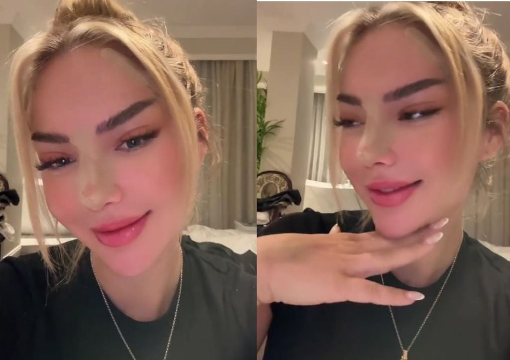 Völlig anders: Emma Fernlund zeigt nach OP ihr neues Gesicht