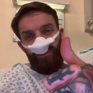Hämatom an der Nase: Ex-"Geordie Shore"-Aaron hatte Not-OP