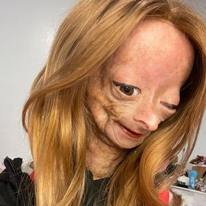 YouTube-Star Adalia Rose Williams mit 15 Jahren gestorben