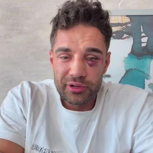 Aleks Petrovic hat Fame-Fighting-Niederlage jetzt akzeptiert