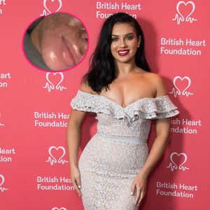 Horror-Pics: "Love Island"-Star zeigt Beauty-OP-Folgen
