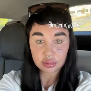 Amanda Bynes präsentiert neue Lippen und Fans sorgen sich