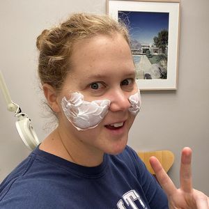 Wangen wie Maleficent: Amy Schumer bekommt Filler entfernt