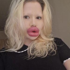 Neben XXL-Lippen: Andrea Ivanova plant neue Beauty-Projekte