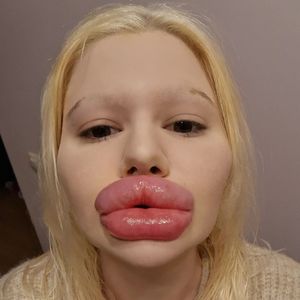 Nach Mega-Lippen: Andrea Ivanova will komplett neues Gesicht