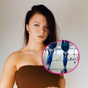 Angie verlor beide Beine – und ist jetzt ein Tik-Tok-Star