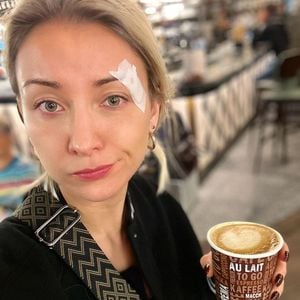 Duschunfall: Anna-Carina Woitschack hat eine Platzwunde!
