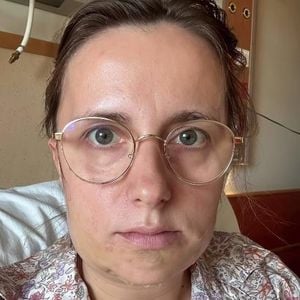 So sieht Anna Heisers Unterkiefer nach ihrer Operation aus!