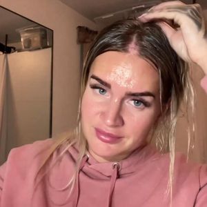Haar-Fail: Anna Iffländer hat kahle Stellen auf dem Kopf!