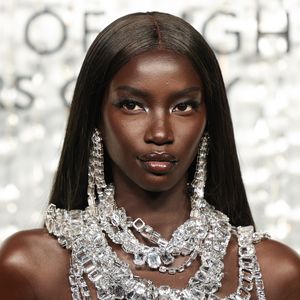 Nach Lungen-OP: Supermodel Anok Yai kämpft mit einer Sepsis