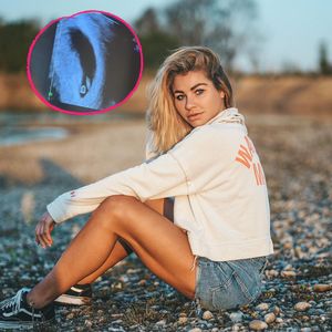 Antonia Elena teilt erste Ultraschallaufnahme ihres Babys!