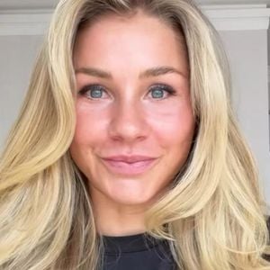 Christian Wolf über Antonia: Keine Mimik mehr durch Hyaluron