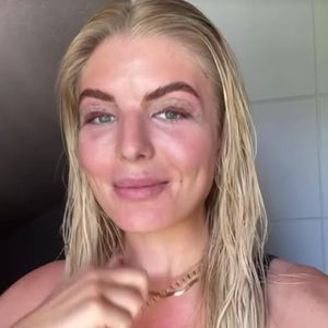 Drei Tage nach der Lidstraffung: Wie geht es Antonia Hemmer?