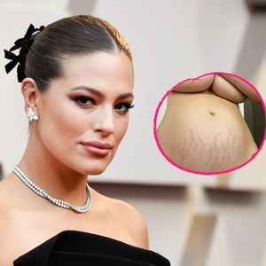 Schwangerschaftsstreifen: Ashley Graham postet ehrliches Pic