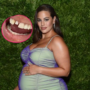 Hochschwangerer Ashley Graham wird Veneer rausgeschlagen!