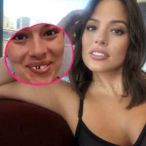 Wegen gefrorener Kekse: Ashley Graham bricht sich Zahn ab
