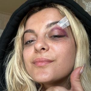 Nach Unfall mit Handy: Bebe Rexha meldet sich bei ihren Fans