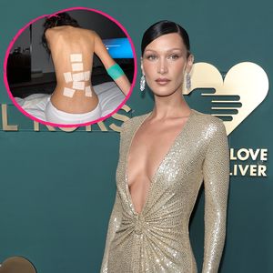 Pflaster und Hämatome: Fans sind besorgt um Bella Hadid