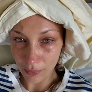 Beunruhigende Bilder: Bella Hadid kämpft mit Lyme-Borreliose