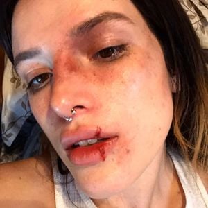 Fans in Sorge: Wurde Bella Thorne etwa blutig geschlagen?