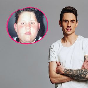"Big Brother"-Pat wurde als Teenager für Aussehen gemobbt