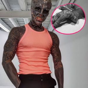 Zwei Finger amputiert! Franzose transformiert sich zum Alien