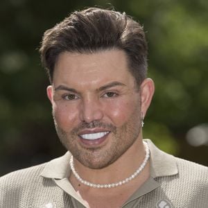 Bobby Norris auf Passfoto nach den Beauty-OPs nicht erkannt