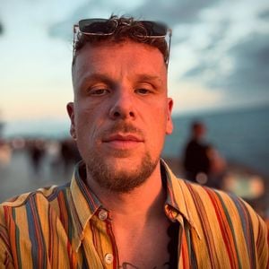 Freundin von Bonez MC teilt Fotos nach Aquafacial-Albtraum