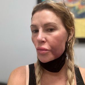 Online-Hass: Brandi Glanville kehrt aus Netz-Pause zurück