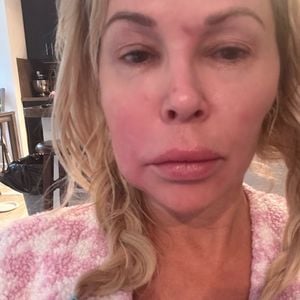 Brandi Glanville teilt ein besorgniserregendes Zittervideo