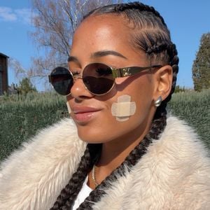 Nach Grübchen-Eingriff: Brenda Brinkmann muss in Klinik