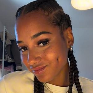 "Steht mir": Brenda Brinkmann ließ sich Grübchen modellieren