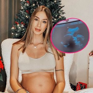 Intimer Einblick: Brenda Patea zeigt Ultraschall ihres Babys