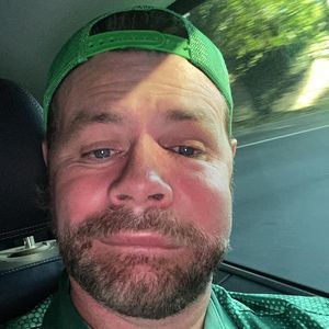 Nach Bienenstich: Brian McFaddens Gesicht total geschwollen