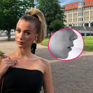 Hanni Hase zeigt Vorher-Nachher-Foto ihrer Beauty-Eingriffe