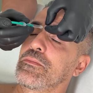 Wegen starker Migräne: Bushido lässt sich Botox spritzen