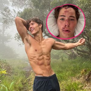 Erste Worte von TikToker Caleb Coffee nach Klippensturz!