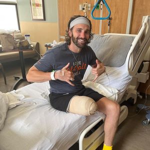 Lymphödem: US-Bachelorette-Star wurde das Bein amputiert!