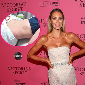 Babyplanung durch? Candice Swanepoel lässt Bauch straffen