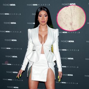 Wegen Hautproblemen: Cardi B sucht Rat bei ihren Followern