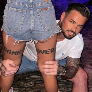 Nicht Katies: Mit wessen Frauenbeinen posiert Carl Woods?