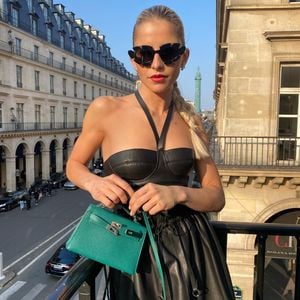 Blaues Auge: Caro Daur nur noch mit Sonnenbrille unterwegs