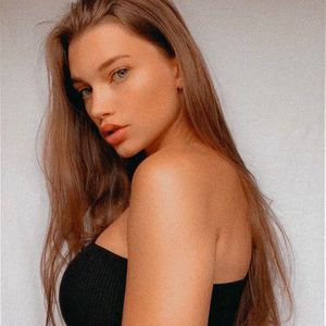 Falsch behandelt: GNTM-Chanel stand kurz vor Amputation!
