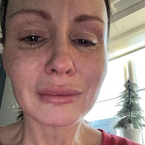 "Es geht mir nicht gut": Chanelle Hayes teilt traurige Fotos