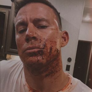 Blutverschmiert: Was ist hier mit Channing Tatum passiert?
