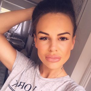 Zu viel des Guten? Chantelle Connelly zeigt XXL-Lippen