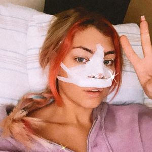 Wie Charli: TikTok-Sternchen Chany Dakota hatte Nasen-OP