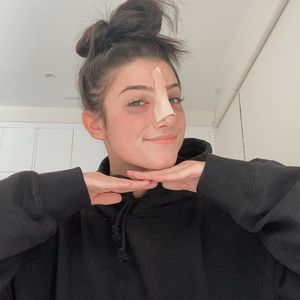 Beauty-Eingriff? TikTok-Star Charli D'Amelio hatte Nasen-OP