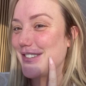 UK-Star Charlotte Crosby ließ sich ihre Lipfiller entfernen!