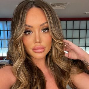 Charlotte Crosby verabschiedet sich von ihren Lipfillern